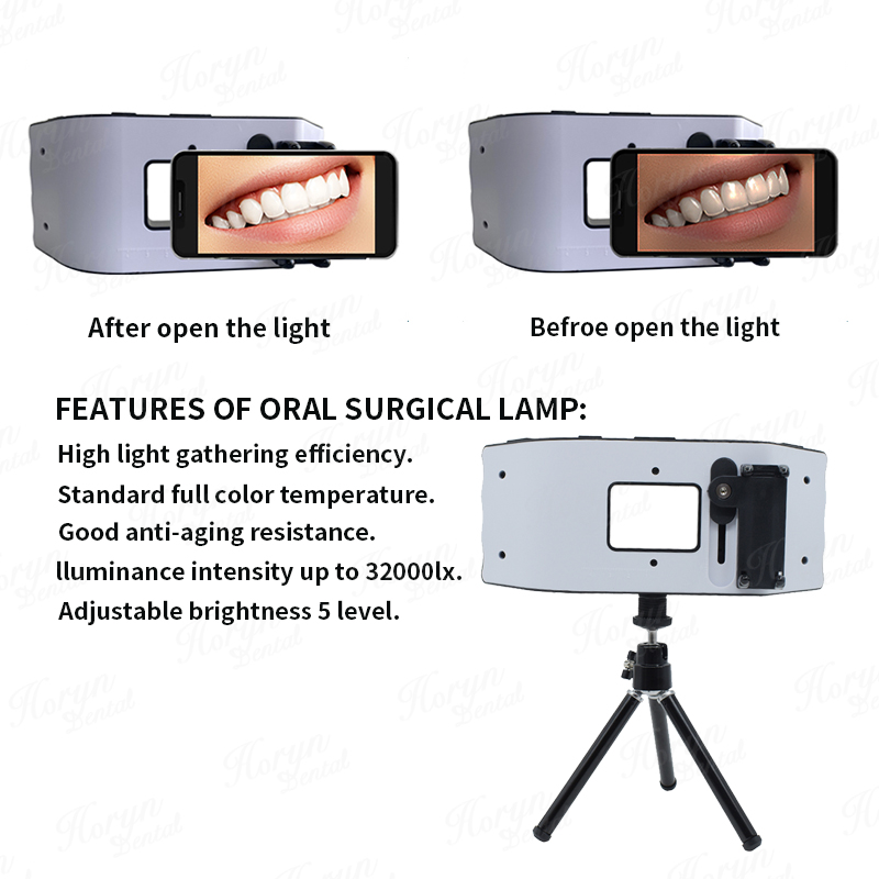 Dental Flash Light Photography - Photography Lighting Led recension och pris